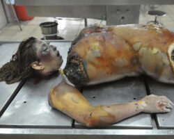 Rotten and dismembered in morgue