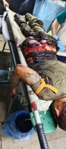 Seriously injured Russian soldier after Ukrainian drone attack