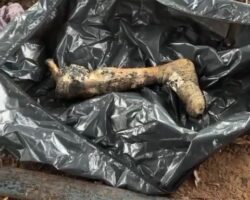Severed human leg found in garbage bag