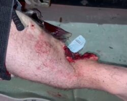 Soldier suffered injury to his leg