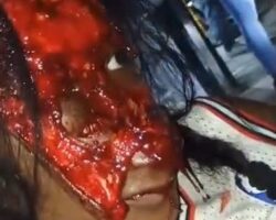 Two seriously injured women following traffic accident