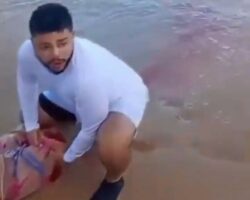 19-year-old woman attacked by shark in Recife, Brazil
