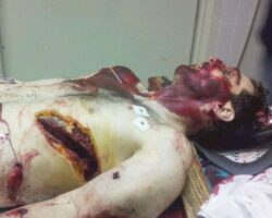 Corpse of Boston marathon attacker