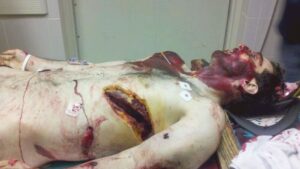 Tamerlan Tsarnaev