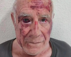 Elderly man brutally attacked by three scumbags