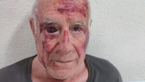 Elderly man brutally attacked by three scumbags