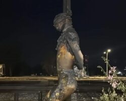 Guy burned by Mexican drug cartel