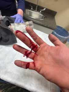 Hand cut with knife