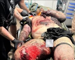 Heavily injured Ukrainian soldier receiving treatment in field hospital