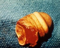 His wife cut off his penis in his sleep
