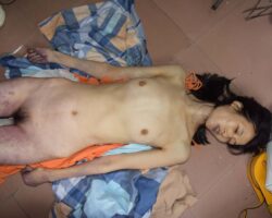 Initial examination of hanged Chinese woman #4