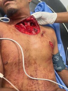 Man suffers neck injury after being gored by bull