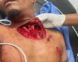 Man suffers neck injury after being gored by bull