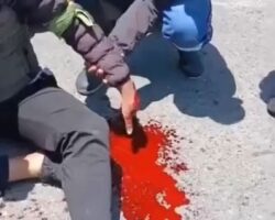 Motorcyclist lost his hand in crash