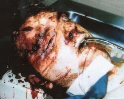 Postmortem photos of Jeffrey Dahmer
