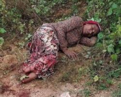 Robbers cut off both of her feet