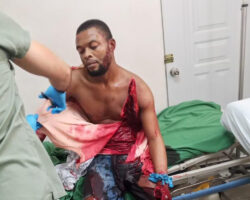 Seriously injured in machete attack