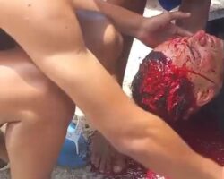 Shot in head during armed robbery