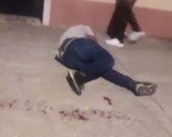 Stabbed during street fight #3