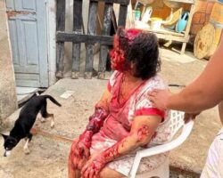 Woman brutally attacked by her own dog