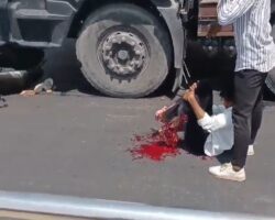Both legs crushed by truck