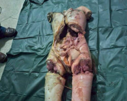 Dismembered woman found in Bangkok apartment