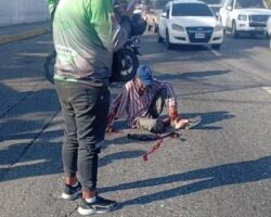 Elderly man struck by vehicle in hit-and-run accident