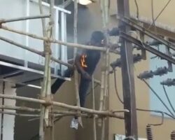 Electrician burned to the bone by high voltage