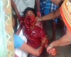 Indian teenager seriously injured by phone explosion
