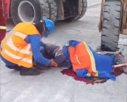 Leg amputated in industrial accident