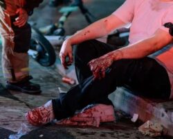 Man’s hand severely mangled in fireworks accident