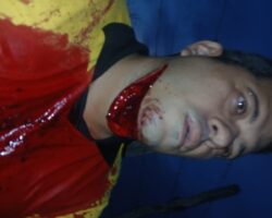 Mototaxi driver got his throat slit during robbery