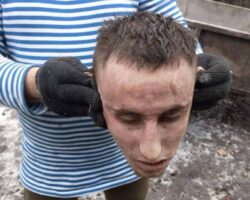 Severed head of Ukrainian soldier as war trophy