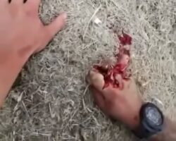 Soldier suffered serious hand injury while operating mortar