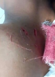 Stabbed by gang of juveniles in Bangladesh