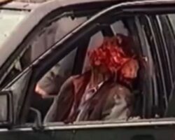 Aftermath of Boris Berezovsky assassination attempt