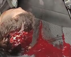 Cop shot in head with his own gun