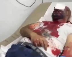 Hospital overwhelmed after attack on Hezbollah members