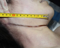 Initial examination of hanged Chinese woman #5