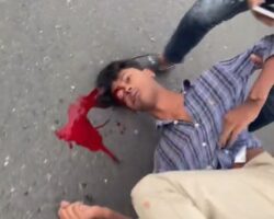Injured motorcyclist following crash