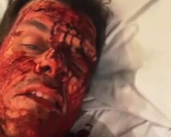 Perez Hilton hospitalized after disturbing TikTok livestream