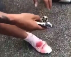Shot in foot while playing Russian roulette