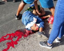 Two motorcyclists seriously injured in traffic accident
