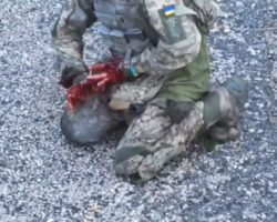 Ukrainian soldier lost both hands