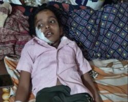 8-year-old girl attacked by stray cow