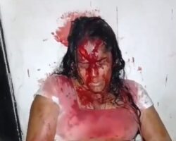 Couple attacked and stabbed by her ex-partner