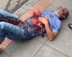 Man bleeds from deep abdominal wound