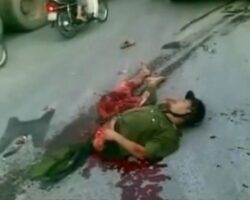 Man survives being crushed in half by truck