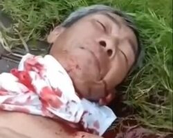 Mentally ill man had his throat cut during brawl