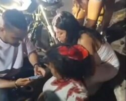 Motorcycle crash killed him and left her scalped